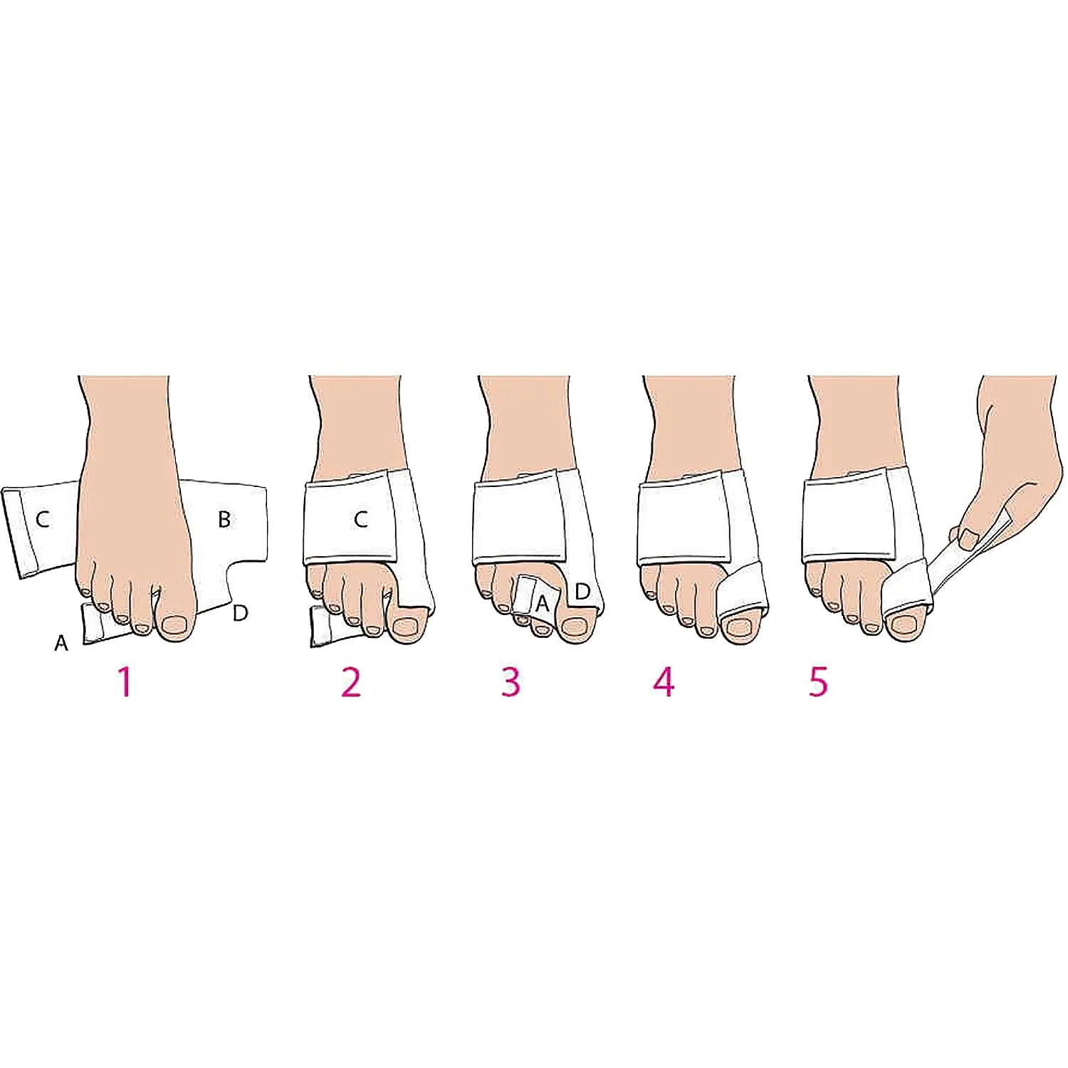 Unisex PediFix Bunion SoftSplint